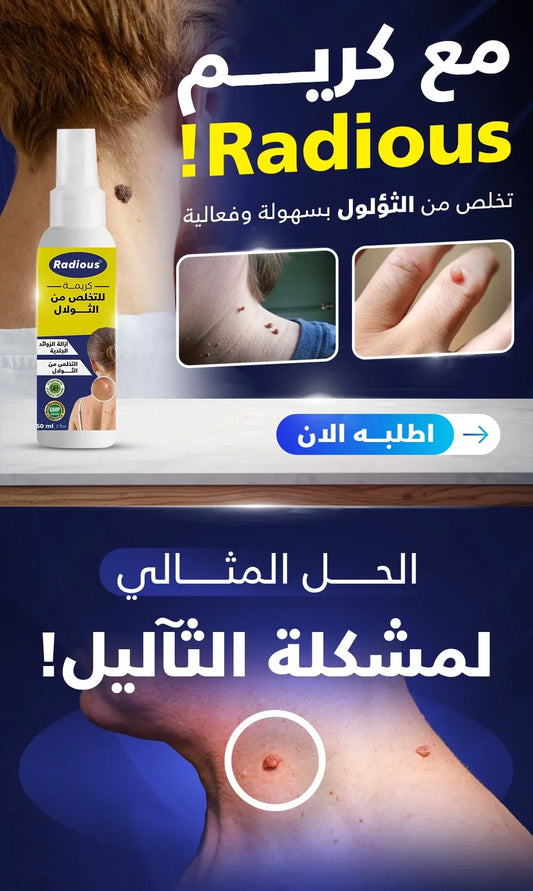 كريم راديوس